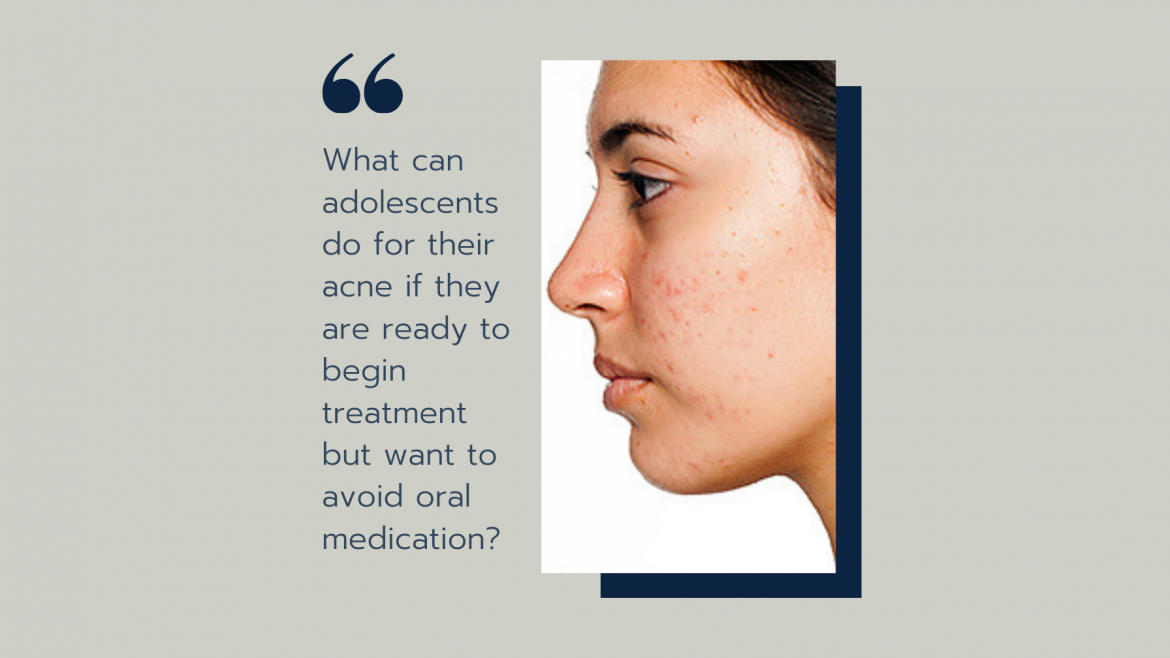 What can adolescents do for their acne if they are ready to begin treatment but want to avoid oral medication?