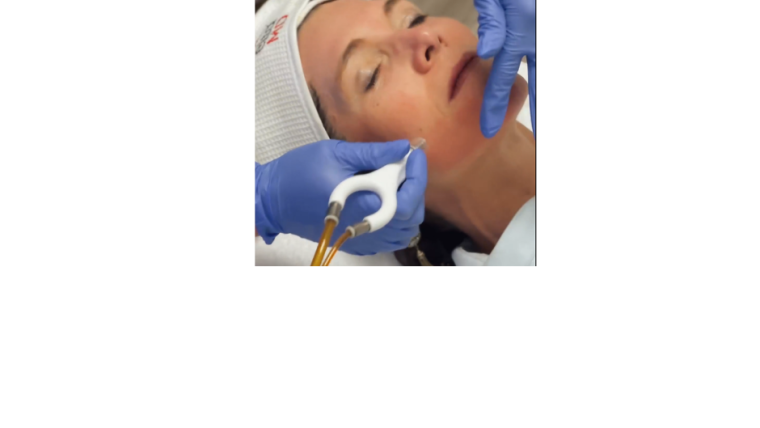 Why Summer is the Perfect Time for a HydraFacial or DiamondGlow