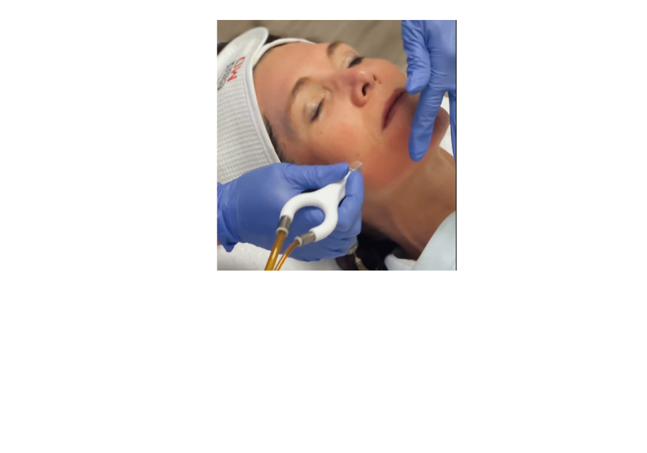 Why Summer is the Perfect Time for a HydraFacial or DiamondGlow